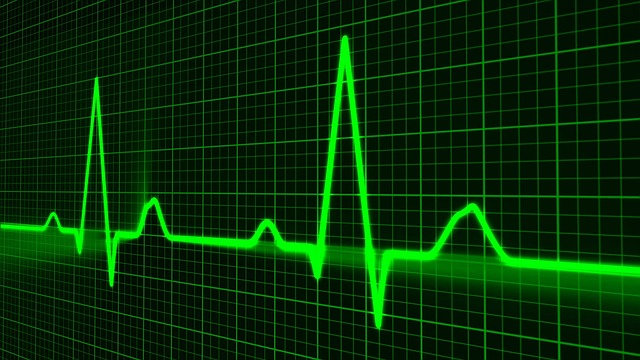 Life Insurance After Heart Attack, Heart Monitor Readout Picture